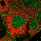 Immunofluorescent staining of human cell line HEK 293 shows localization to nucleus & plasma membrane.