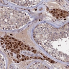 Anti-TRAPPC2L Antibody