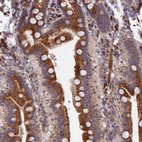 Immunohistochemical staining of human duodenum shows strong granular cytoplasmic positivity in glandular cells.
