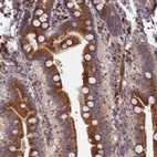 Immunohistochemical staining of human duodenum shows strong granular cytoplasmic positivity in glandular cells.