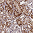 Immunohistochemical staining of human kidney shows strong granular cytoplasmic positivity in cells in tubules.