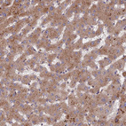 Immunohistochemical staining of human liver shows moderate granular cytoplasm positivity in hepatocytes.