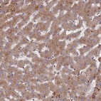Immunohistochemical staining of human liver shows moderate granular cytoplasm positivity in hepatocytes.
