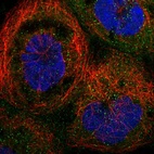 Immunofluorescent staining of human cell line A-431 shows localization to cytosol & vesicles.