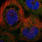 Immunofluorescent staining of human cell line A-431 shows localization to cytosol & vesicles.