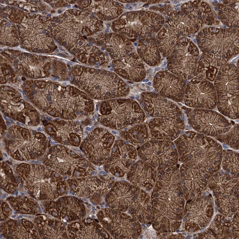 Anti-PCCA Antibody