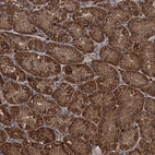 Anti-PCCA Antibody