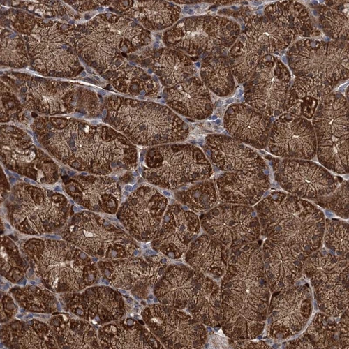 Anti-PCCA Human Protein Atlas Antibody