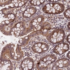 Anti-CCDC184 Antibody