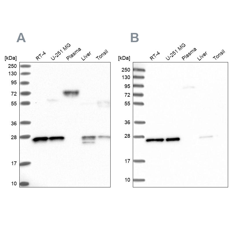 Anti-MESDC2 Antibody