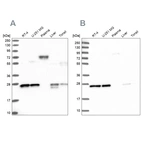 Anti-MESDC2 Antibody