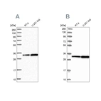 Western blot analysis using Anti-TBCB antibody HPA041722 (A) shows similar pattern to independent antibody HPA041428 (B).