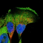 Immunofluorescent staining of human cell line U-251 MG shows localization to cytosol.