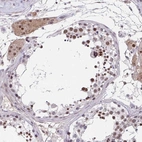 Anti-RBBP6 Antibody