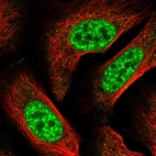 Immunofluorescent staining of human cell line U-2 OS shows localization to nuclear speckles.