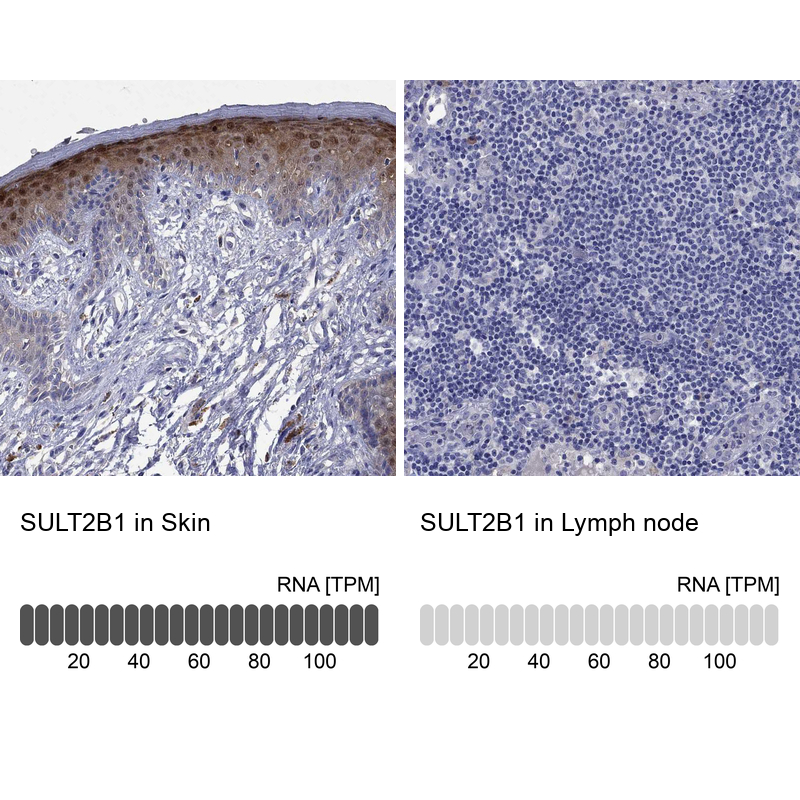 Anti-SULT2B1 Antibody