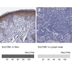 Anti-SULT2B1 Antibody