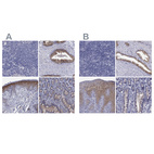Immunohistochemical staining of human lymph node, prostate, skin and small intestine using Anti-SULT2B1 antibody HPA041724 (A) shows similar protein distribution across tissues to independent antibody HPA043539 (B).