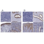 Immunohistochemical staining of human lymph node, prostate, skin and small intestine using Anti-SULT2B1 antibody HPA041724 (A) shows similar protein distribution across tissues to independent antibody HPA043539 (B).