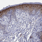 Immunohistochemical staining of human skin shows strong nuclear positivity in squamous epithelial cells.