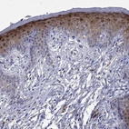Immunohistochemical staining of human skin shows strong nuclear positivity in squamous epithelial cells.