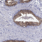 Immunohistochemical staining of human prostate shows strong granular cytoplasmic positivity in glandular cells.