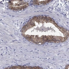 Immunohistochemical staining of human prostate shows strong granular cytoplasmic positivity in glandular cells.