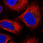 Immunofluorescent staining of human cell line U-2 OS shows localization to vesicles.