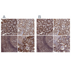 Anti-PLA2G15 Antibody