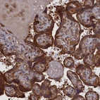 Immunohistochemical staining of human placenta shows strong granular cytoplasmic positivity in trophoblastic cells.