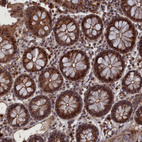 Immunohistochemical staining of human colon strong granular cytoplasmic positivity in glandular cells.