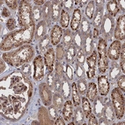 Immunohistochemical staining of human kidney shows strong granular cytoplasmic positivity in cells in tubules.