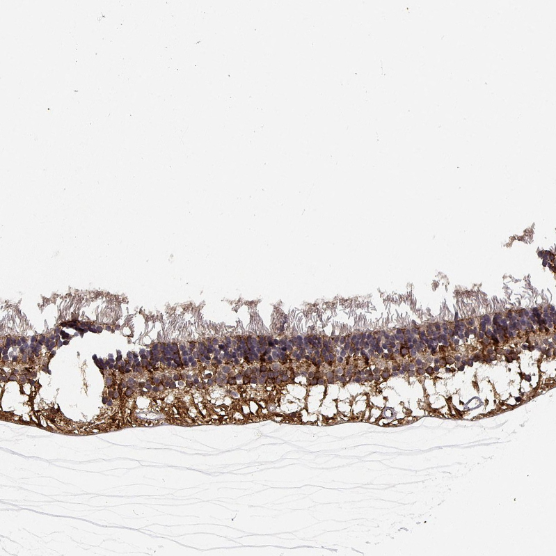 Anti-NPVF Antibody
