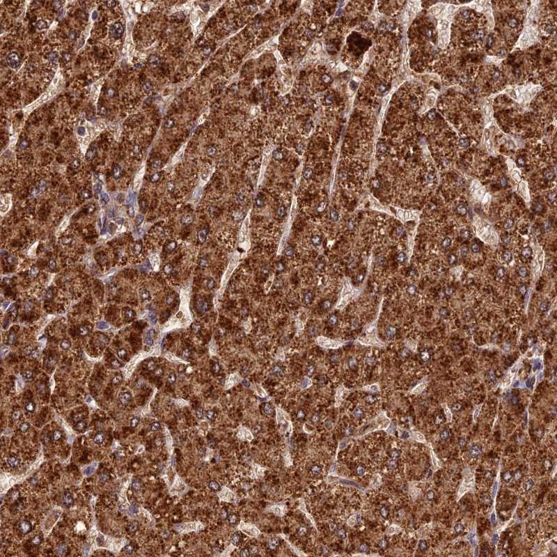 Anti-CORO1C Antibody