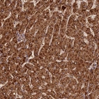 Anti-CORO1C Antibody