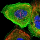 Immunofluorescent staining of human cell line A-431 shows localization to plasma membrane & cytosol.