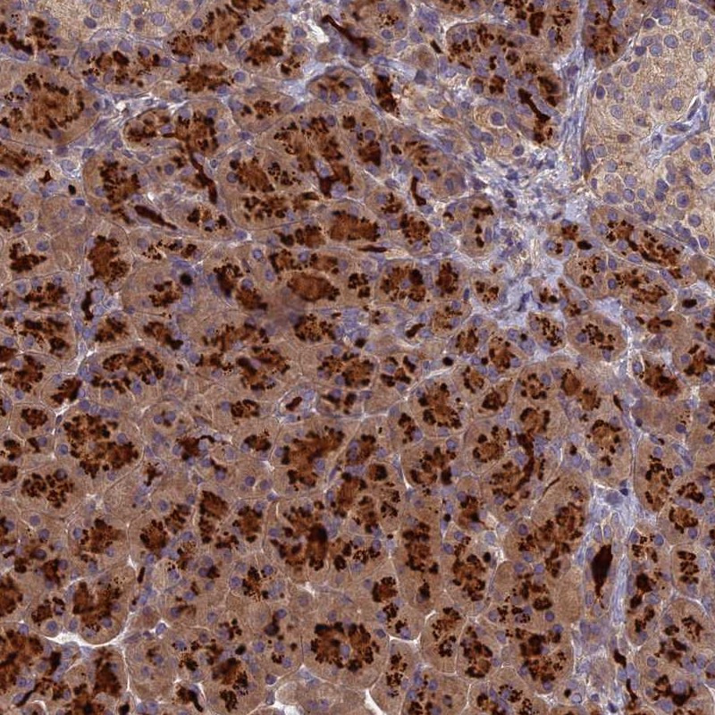 Anti-AP4E1 Antibody