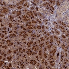 Anti-AP4E1 Antibody