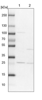 Lane 1: NIH-3T3 cell lysate (Mouse embryonic fibroblast cells)_br/_Lane 2: NBT-II cell lysate (Rat Wistar bladder tumour cells)