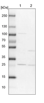 Lane 1: NIH-3T3 cell lysate (Mouse embryonic fibroblast cells)_br/_Lane 2: NBT-II cell lysate (Rat Wistar bladder tumour cells)