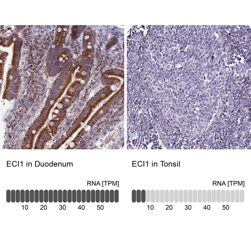Anti-ECI1 Antibody