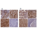 Immunohistochemical staining of human duodenum, kidney, liver and tonsil using Anti-ECI1 antibody HPA041746 (A) shows similar protein distribution across tissues to independent antibody HPA043227 (B).