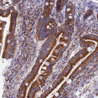 Immunohistochemical staining of human duodenum shows strong granular cytoplasmic positivity in glandular cells.