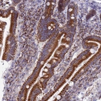 Immunohistochemical staining of human duodenum shows strong granular cytoplasmic positivity in glandular cells.