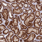 Immunohistochemical staining of human kidney shows strong granular cytoplasmic positivity in cells in tubules.