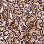 Immunohistochemical staining of human kidney shows strong granular cytoplasmic positivity in cells in tubules.