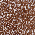 Immunohistochemical staining of human liver shows strong granular cytoplasmic positivity in hepatocytes.