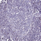 Immunohistochemical staining of human tonsil shows very weak granular cytoplasmic positivity in germinal center cells.