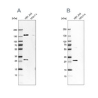 Western blot analysis using Anti-ECI1 antibody HPA041746 (A) shows similar pattern to independent antibody HPA043227 (B).