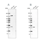 Western blot analysis using Anti-ECI1 antibody HPA041746 (A) shows similar pattern to independent antibody HPA043227 (B).